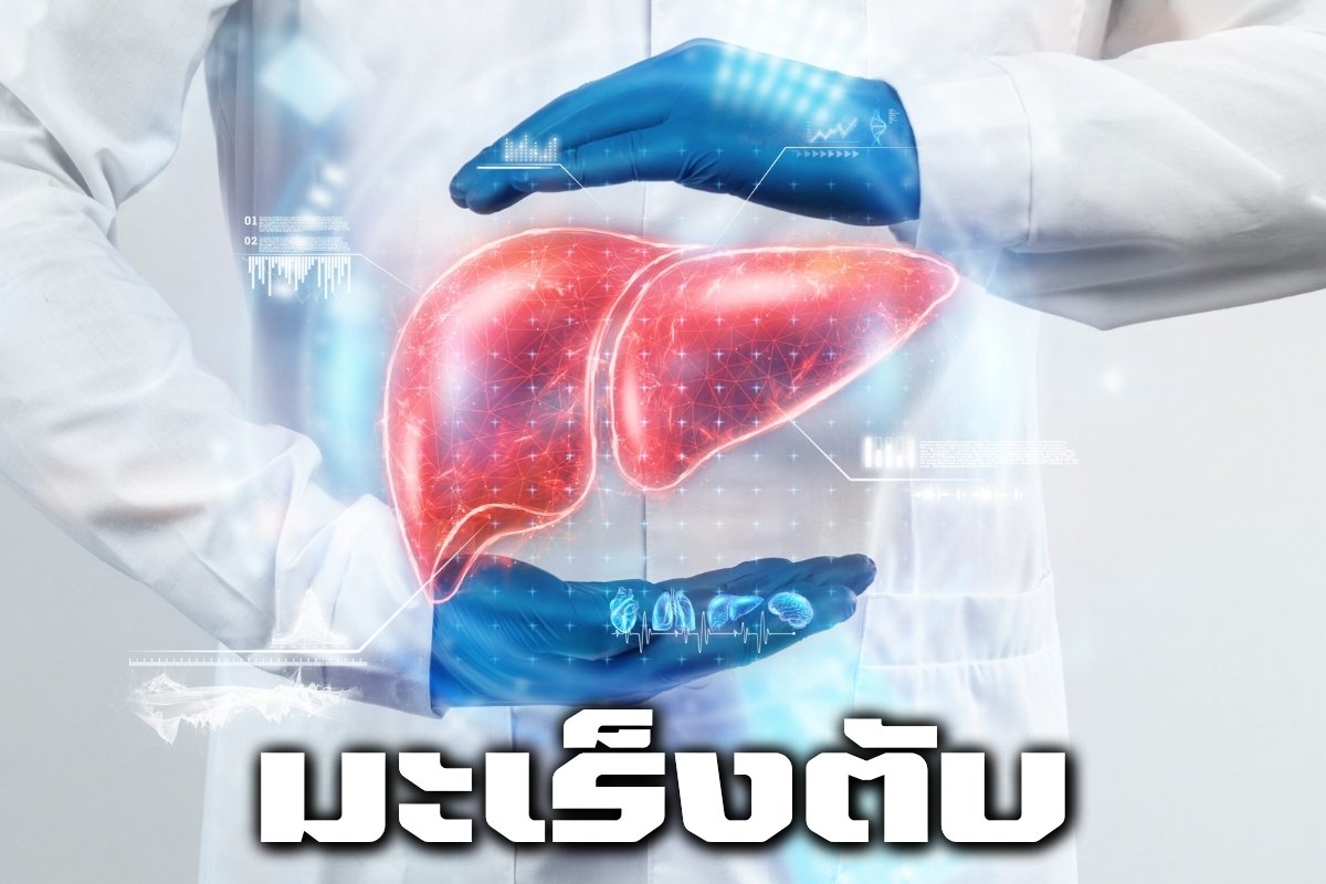 มะเร็งตับ